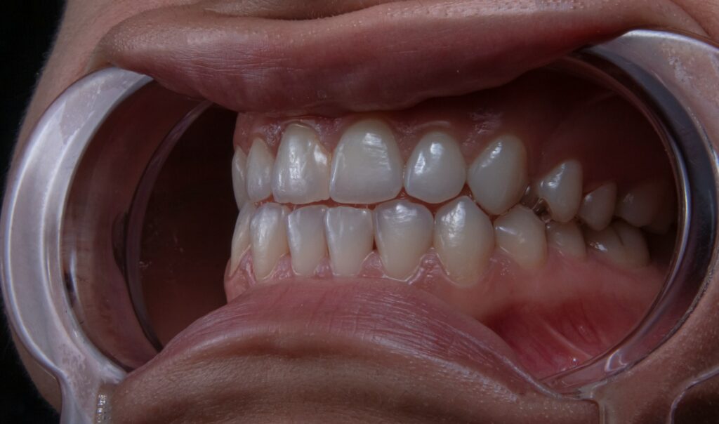 orthodontist assistente opleiding
